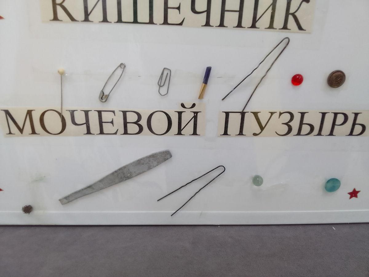 В Усть-Каменогорске «музей» проглоченных предметов постоянно пополняется новыми экспонатами